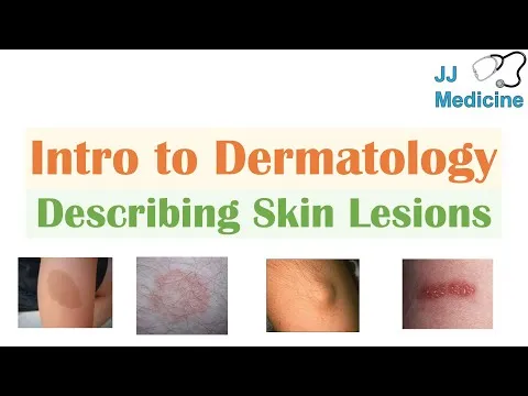 Introduction to Dermatology The Basics Describing Skin Lesions (Primary & Secondary Morphology)