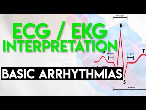 Basic Arrhythmias Sinus Brady Tachy Premature Beats ECG EKG Interpretation (Part 3)