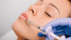 Fillers: Hyaluronic acid injections from plastic surgeon!