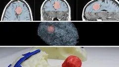 Medical Imaging 3D Modelling and 3D Printing - Beginners