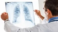 Radiology Xray Exam Questions Practice Test