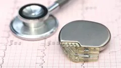 Cardiac Pacemakers- Part 1