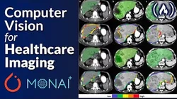 PyTorch and Monai for AI Healthcare Imaging - Python Machine Learning Course